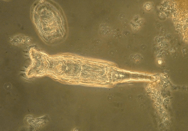 ROTIFER